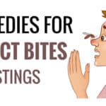 Home Remedies For Insect Bites and stings