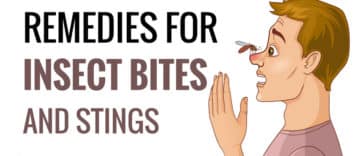 Home Remedies For Insect Bites and stings