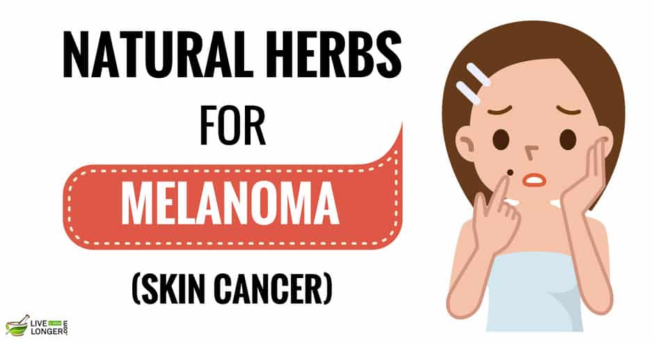 Home Remedies For Melanoma