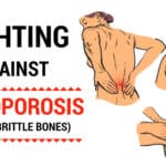 Home Remedies For Osteoporosis