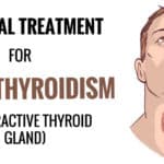 Home Remedies for Hypothyroidism