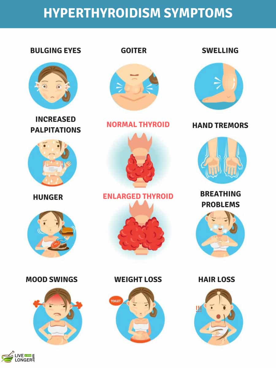 Symptoms of Hyperthyroidism