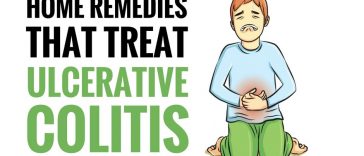 home remedies for ulcerative colitis