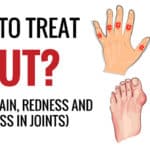 home remedies for gout