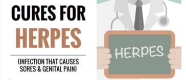 home remedies for herpes