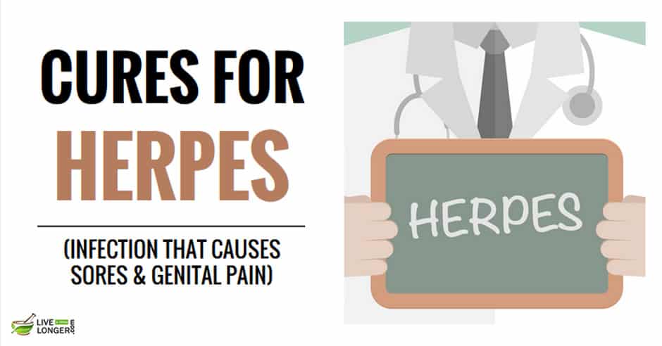 home remedies for herpes