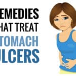 Natural Remedies For Stomach Ulcers
