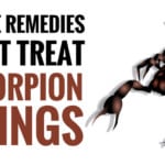 best home remedies for scorpion stings