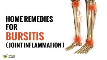 Best remedies For Bursitis