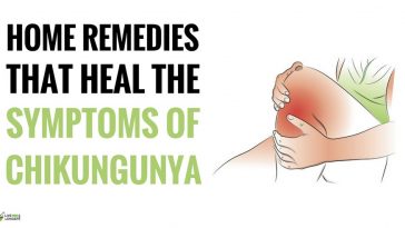 Best Home Remedies For Chikungunya