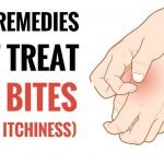 best home remedies for flea bites