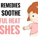 herbal remedies for heat rash