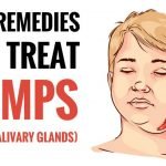 best home remedies for mumps