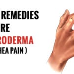 home remedies for Scleroderma
