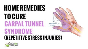 remedies for carpal tunnel syndrome