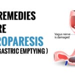 Remedies For Gastroparesis