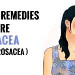 Cure for Rosacea