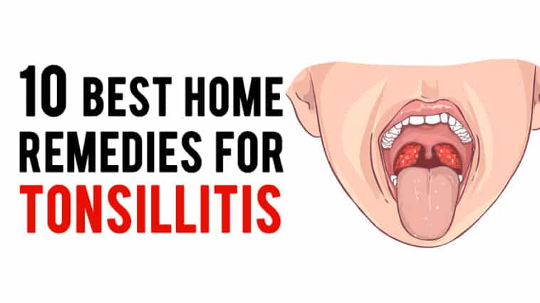 best home remedies for Tonsillitis