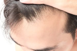 Castor oil for hair growth 