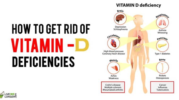 vitamin d deficiency