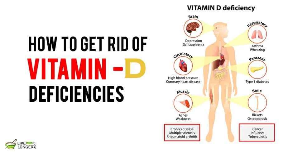 Vitamin deficiency. Vitamin d deficiency. Consequences of Vitamin d deficiency.
