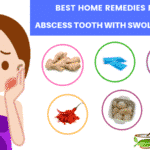home remedies for abscess tooth with swollen face_lll