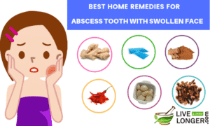 home remedies for abscess tooth with swollen face_lll