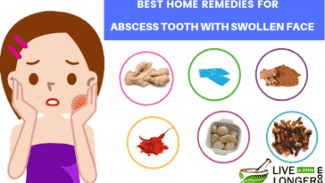 home remedies for abscess tooth with swollen face_lll