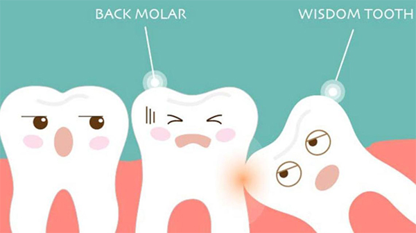 wisdom teeth removal pain