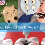 how long does a cavity filling take