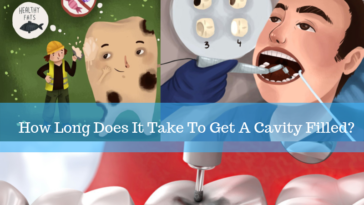 how long does a cavity filling take